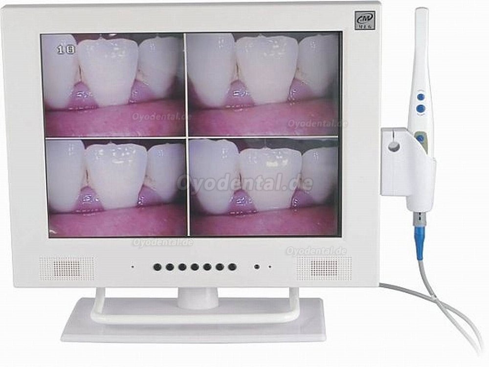 MLG® M-958A 15-Zoll-LCD und 1/4 SONY CCD hohe Auflösende Intraoral kamera