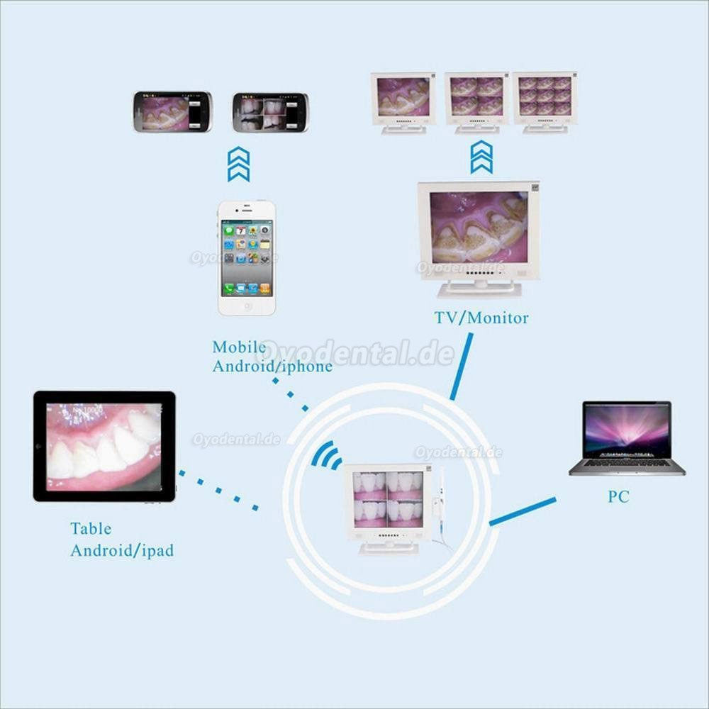 MLG® M-958A 15-Zoll-LCD und 1/4 SONY CCD hohe Auflösende Intraoral kamera