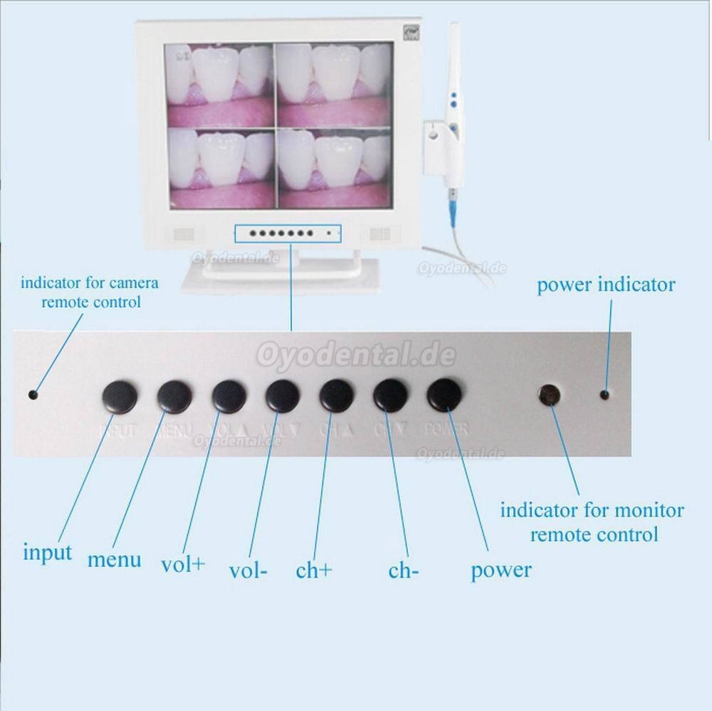 MLG® M-958A 15-Zoll-LCD und 1/4 SONY CCD hohe Auflösende Intraoral kamera