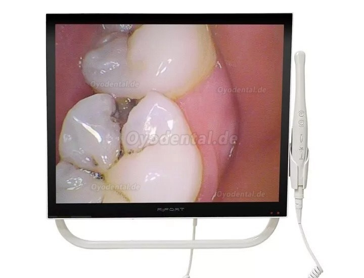 Magenta YFHD-D Dentale Intraoralkamera 1/4 Sony CCD 17-Zoll-Monitor und Stützarmhalterung