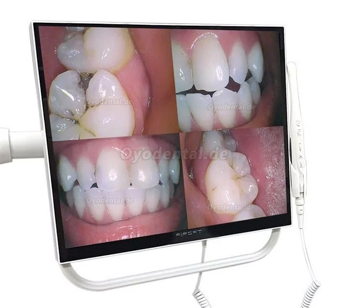 Magenta YFHD-D Dentale Intraoralkamera 1/4 Sony CCD 17-Zoll-Monitor und Stützarmhalterung