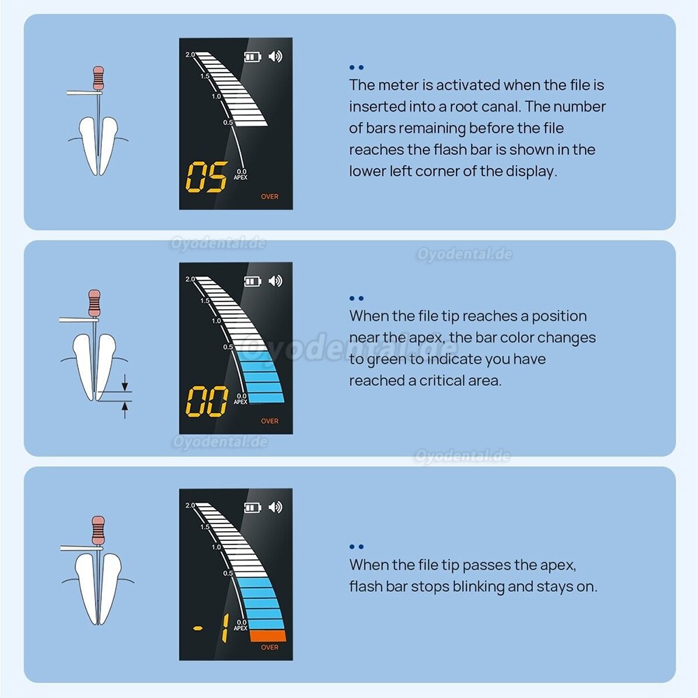 Micropex Pro Endodontisches Apex Lokator Wurzelkanal-Messgerät zur Längenbestimmung