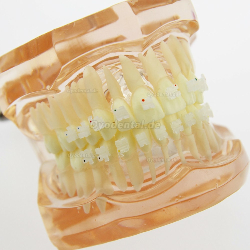 Dental Kieferorthopädie Behandlung Modell Demo Zähne Keramikbrackets # 3002