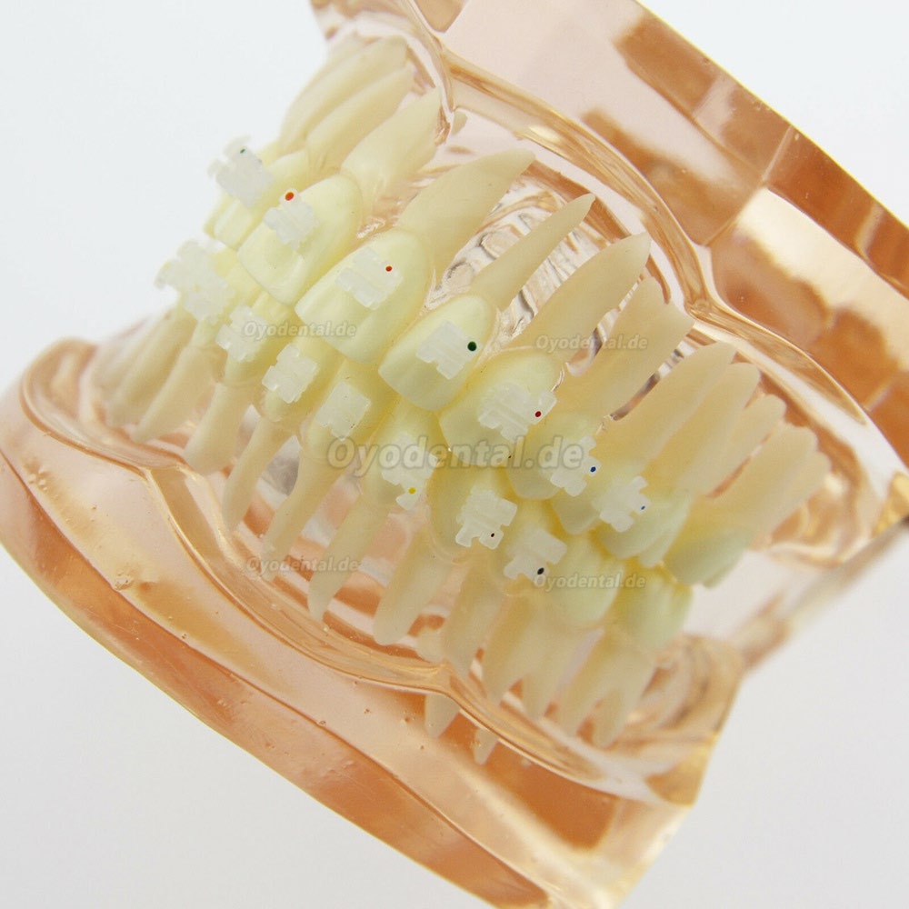 Dental Kieferorthopädie Behandlung Modell Demo Zähne Keramikbrackets # 3002