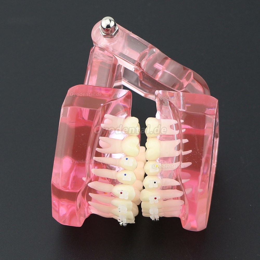 Zahnkieferorthopädisches Zahnmodell Metall- und Keramikbracket Brackets Study Model 3003