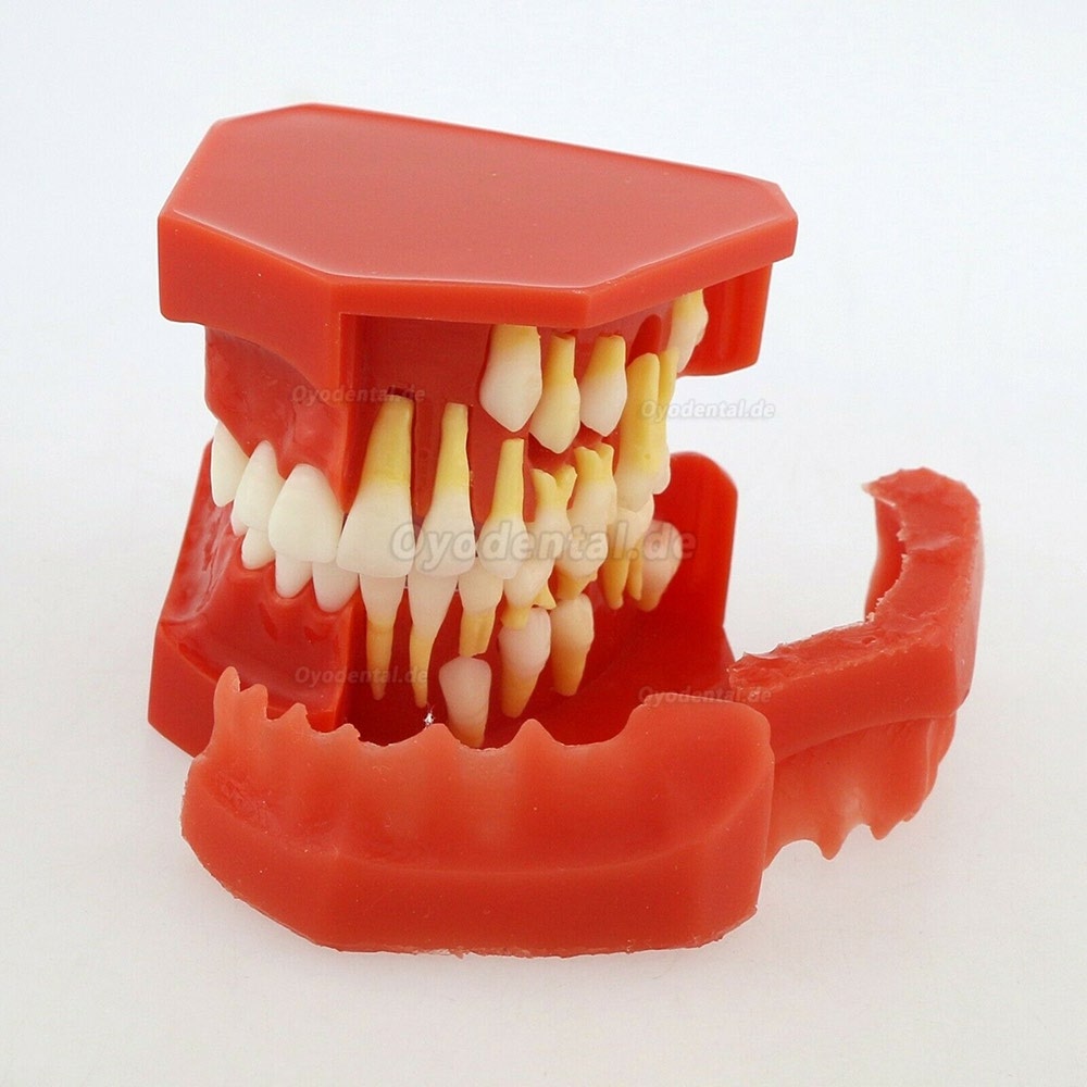 Zahnheilkunde Zähne bleibender Zahn Alternative Demonstrationsstudie Teach Model 4006 #
