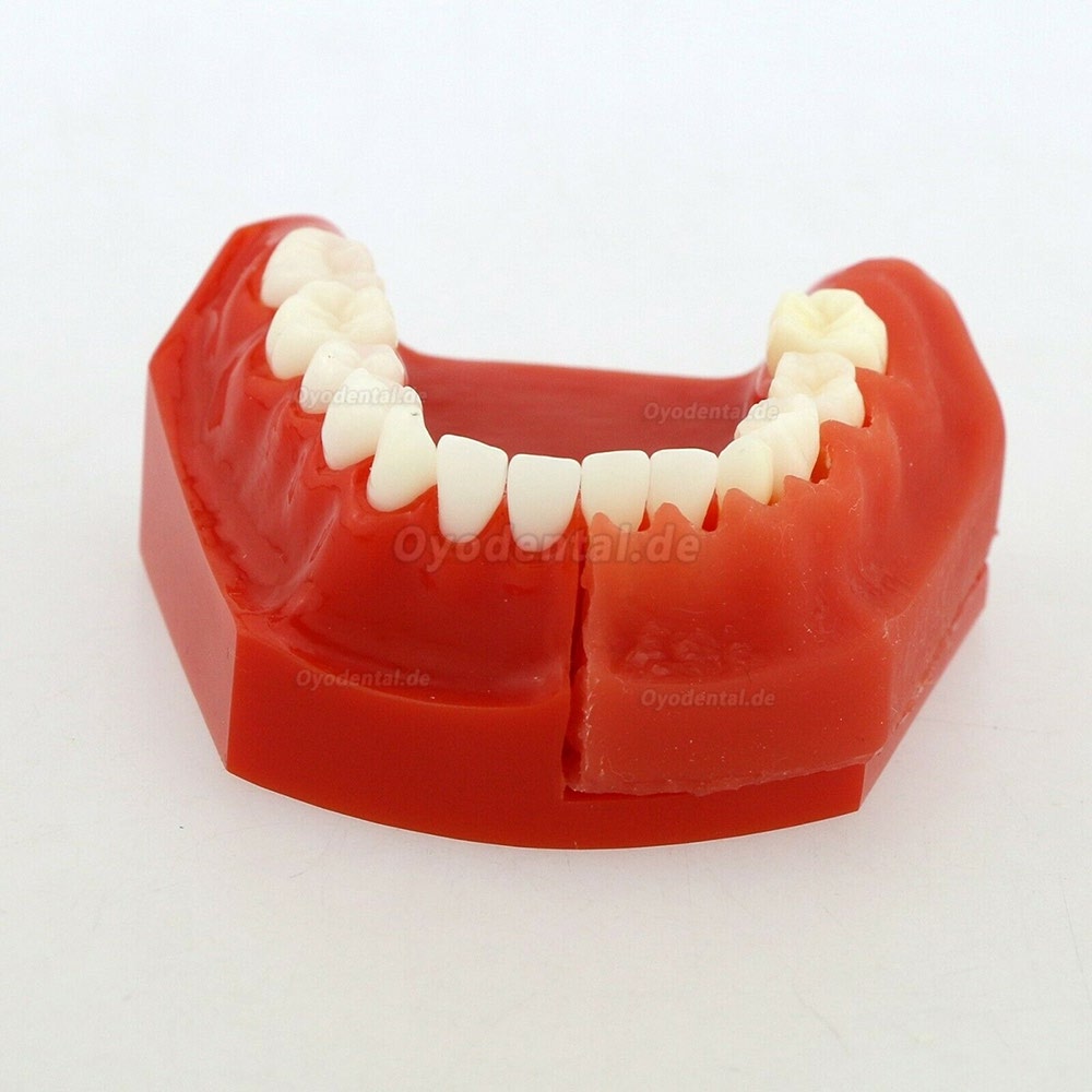 Zahnheilkunde Zähne bleibender Zahn Alternative Demonstrationsstudie Teach Model 4006 #