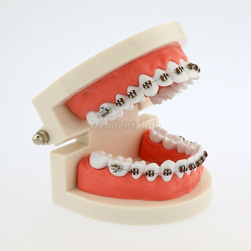 Dental Teach Typodont Demonstrationszahnmodell mit Zahnspangen Für die Patientenstudie 5006