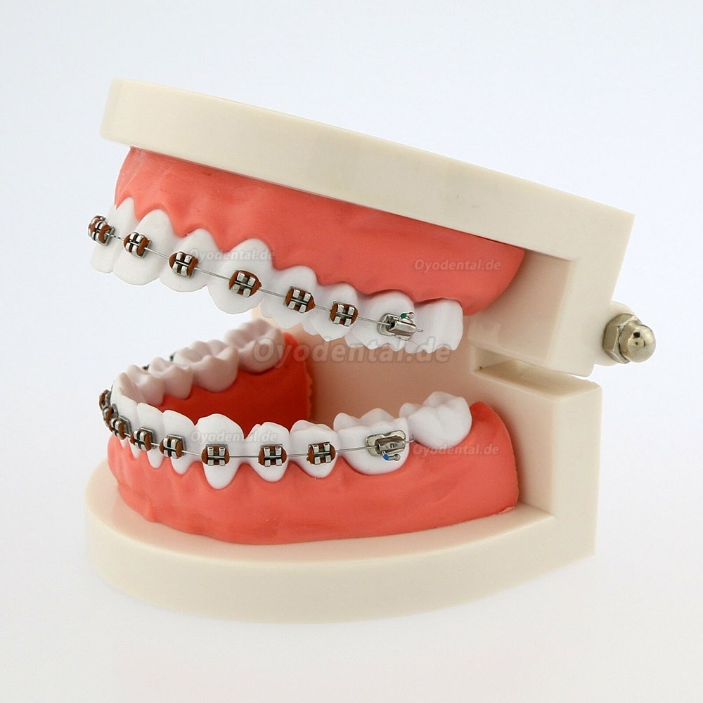 Dental Teach Typodont Demonstrationszahnmodell mit Zahnspangen Für die Patientenstudie 5006