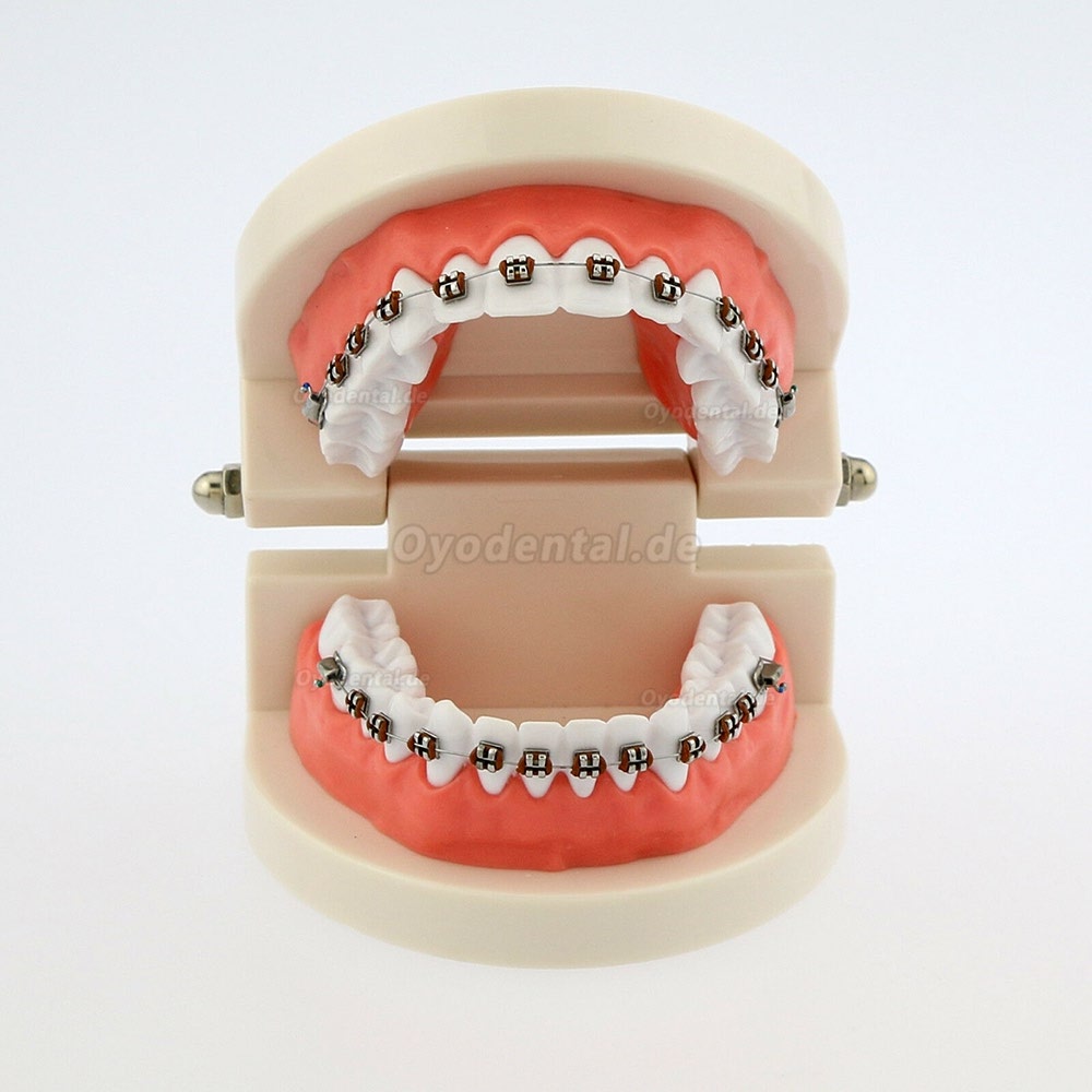 Dental Teach Typodont Demonstrationszahnmodell mit Zahnspangen Für die Patientenstudie 5006