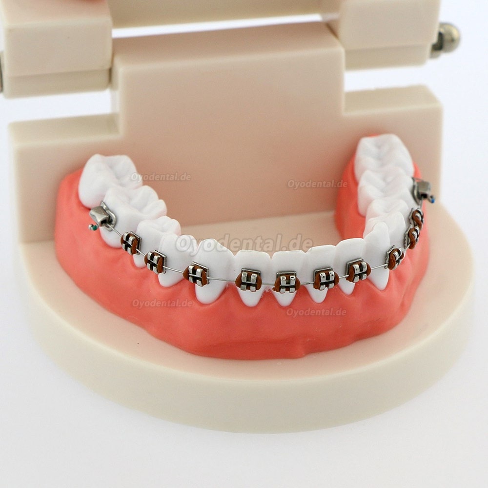 Dental Teach Typodont Demonstrationszahnmodell mit Zahnspangen Für die Patientenstudie 5006