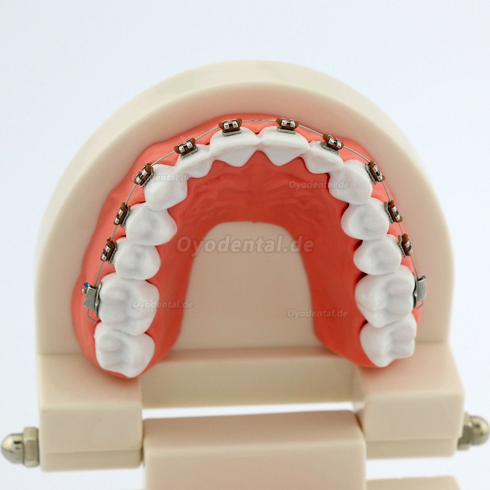 Dental Teach Typodont Demonstrationszahnmodell mit Zahnspangen Für die Patientenstudie 5006