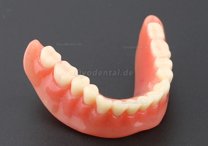 Modell für zahnärztliche Oberzähne Overdenture Superior 4 Implantate Demo Modell 6001 02