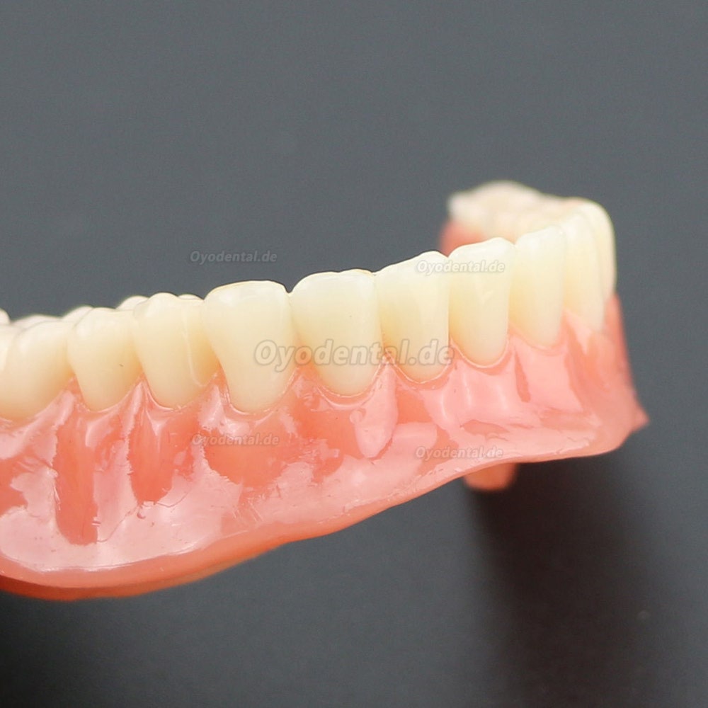 Dental Lower Zähne Demo-Studienmodell 6002 02 Overdenture Unten 4 Implantate