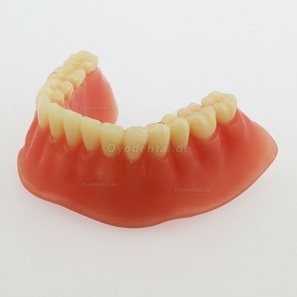 Dental Minderwertige Zähne Modell Overdenture Precision 4 Implantate Demo Silver Bar