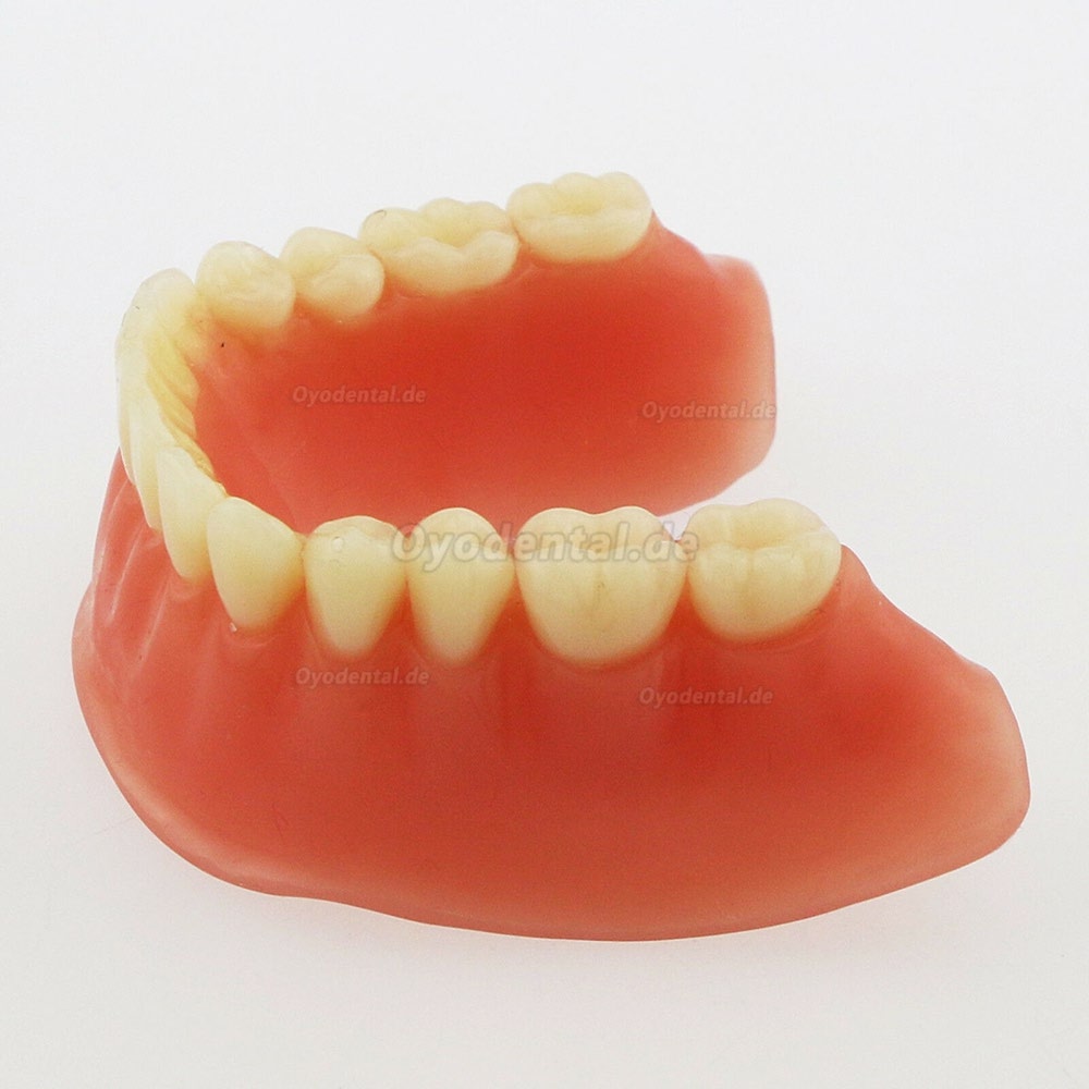 Dental Minderwertige Zähne Modell Overdenture Precision 4 Implantate Demo Silver Bar