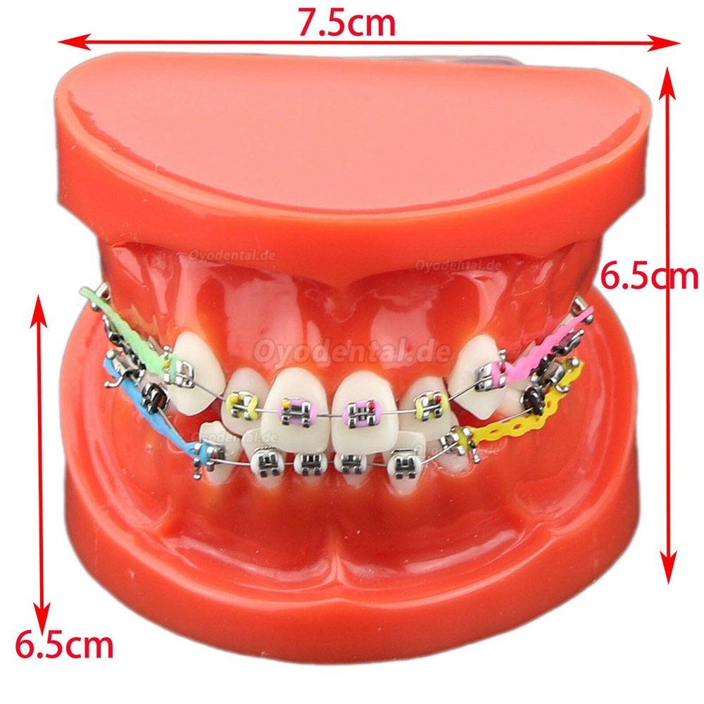 Modell für zahnärztliche kieferorthopädische Zähne + selbstligierende Kette aus Metallkeramik-Bracketrohr