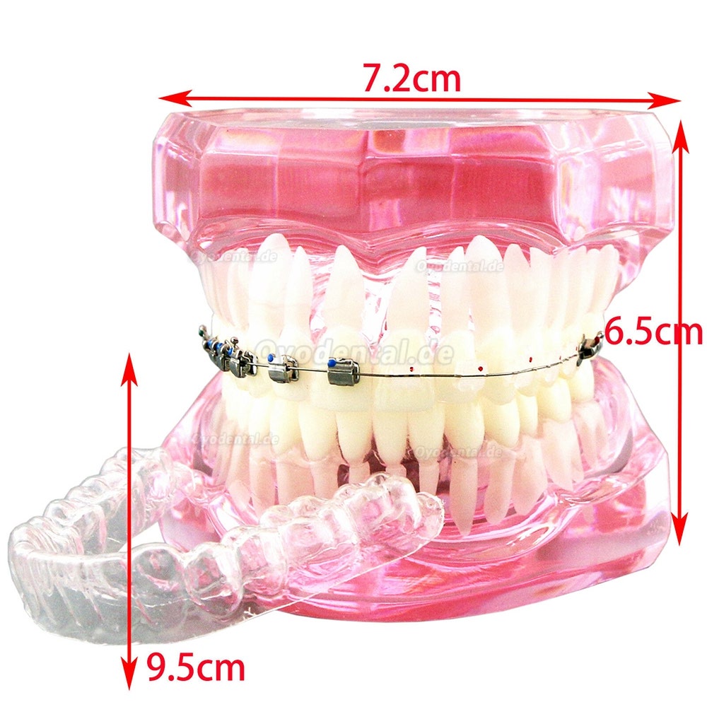 Modell für zahnärztliche kieferorthopädische Zähne + selbstligierende Kette aus Metallkeramik-Bracketrohr