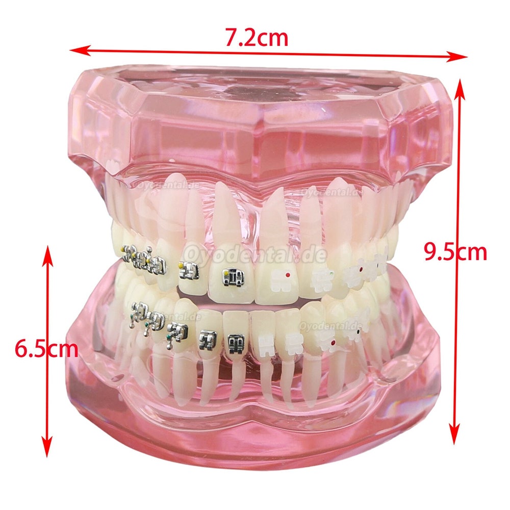 Modell für zahnärztliche kieferorthopädische Zähne + selbstligierende Kette aus Metallkeramik-Bracketrohr