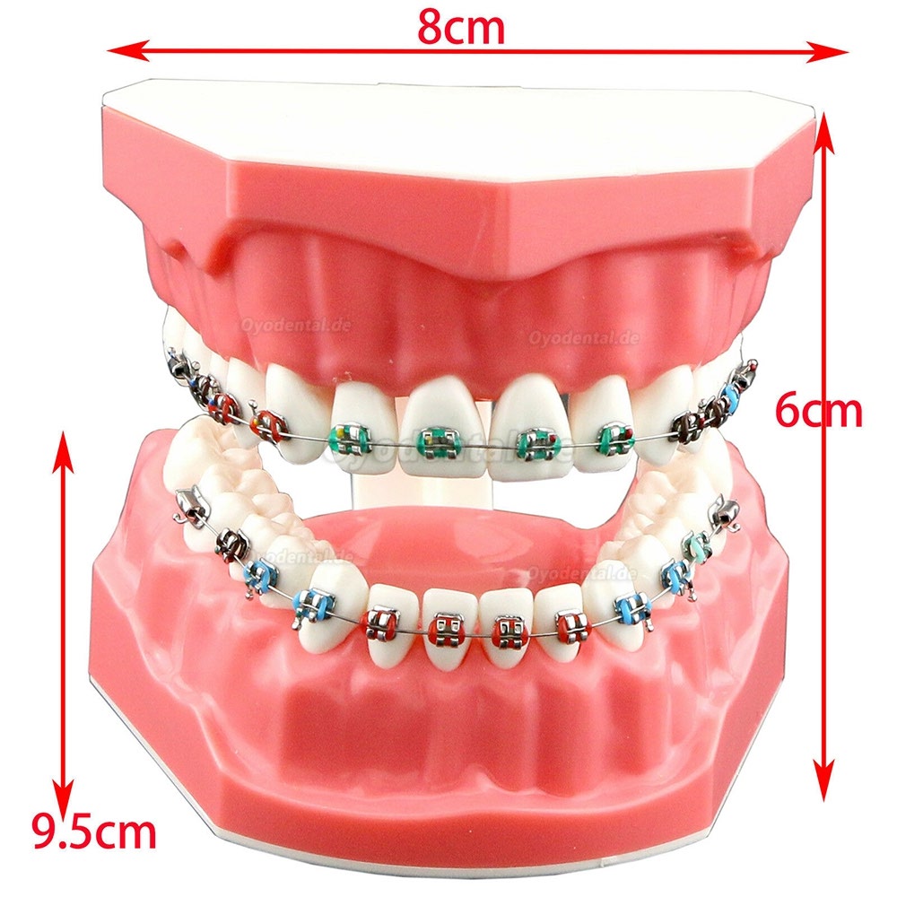 Modell für zahnärztliche kieferorthopädische Zähne + selbstligierende Kette aus Metallkeramik-Bracketrohr