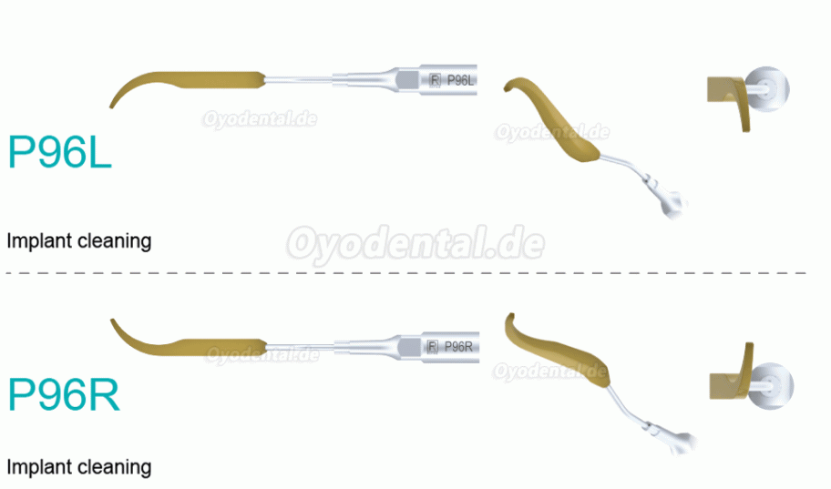 5 Stück Ultraschallspitzen Aufbereitung P90 P94 P95 P96L P96R Kompatibel mit For REFINE EMS MECTRON Woodpeaker