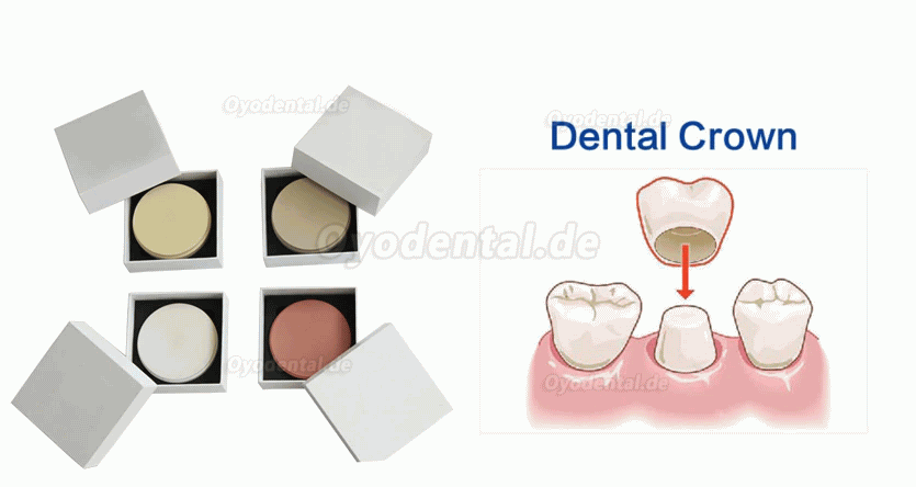 Dental-PEEK-Ronden für Zahnprothetik PEEK-Rohlinge 98 mm, 95 mm 12/14/16/18/20 mm