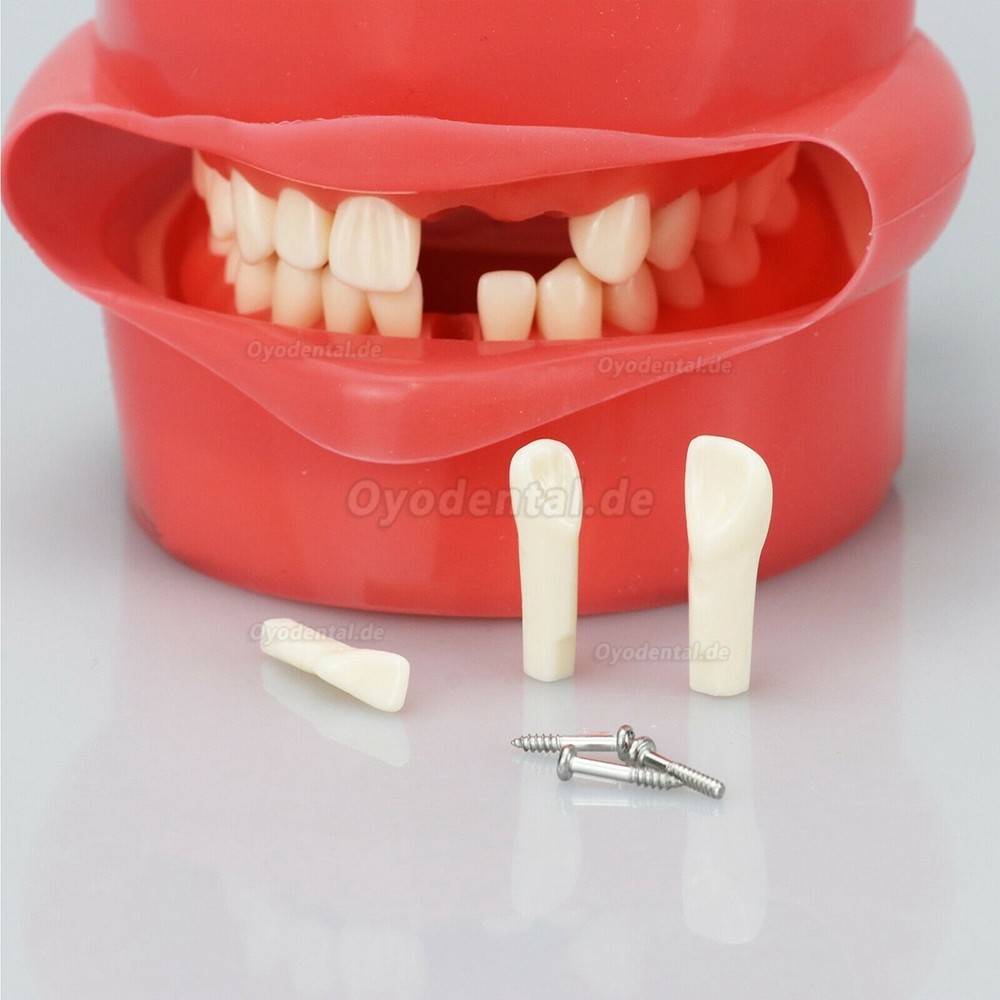 Phantomkopf Dental für Simulationseinheiten Kompatibel mit Nissin Kilgore