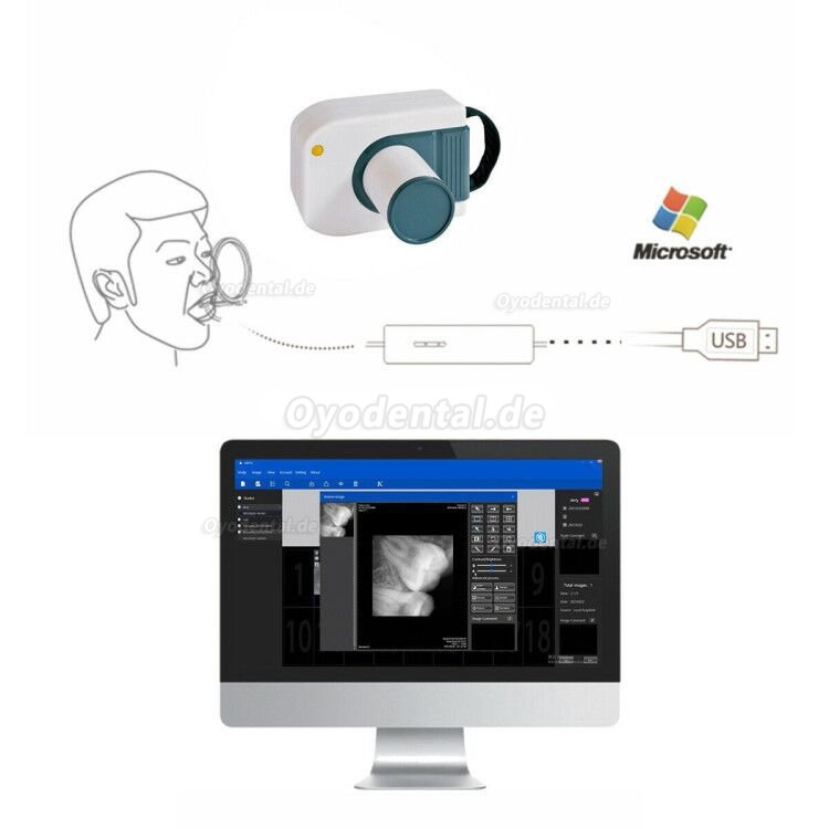 Dental RVG Digitaler Röntgensensor Intraoraler Röntgensensor Intraoralsensoren