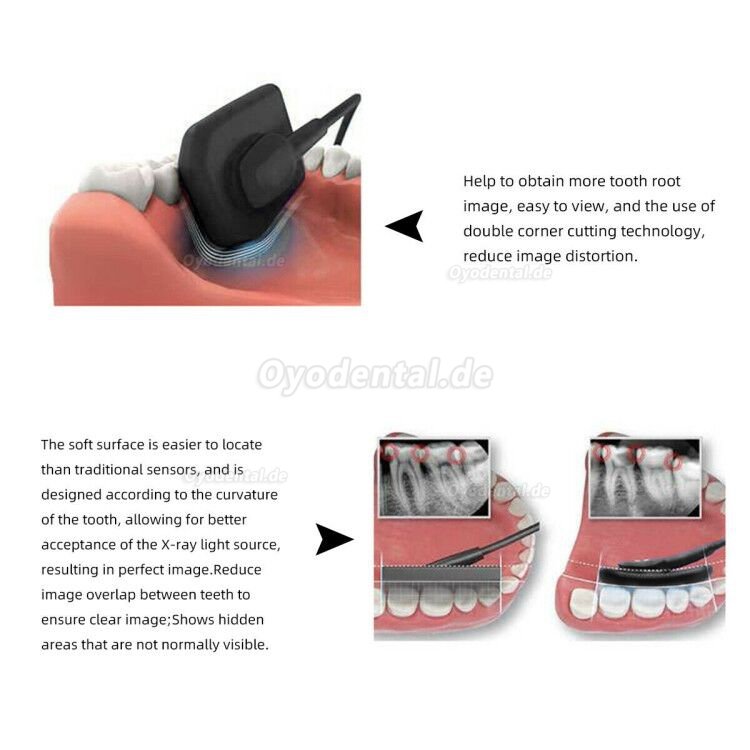 Dental RVG Digitaler Röntgensensor Intraoraler Röntgensensor Intraoralsensoren