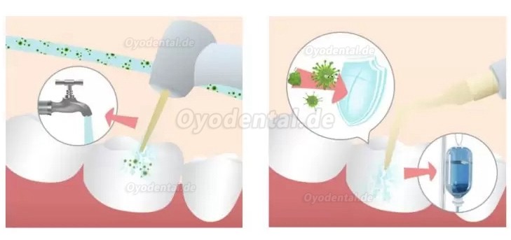 Refine MaxSurgery Geräte für Piezochirurgie Zahnarzt Ultraschall-Piezo-Knochenchirurgiesystem