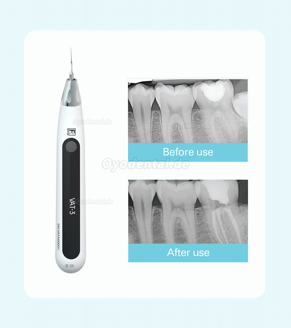 REFINE VAT-3 Zahnärztlicher Endo-Ultraschall-Aktivator Endoactivator Irrigator Kabellos