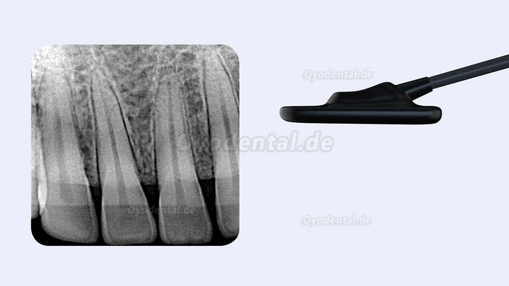 Refine VeRay Tragbares Dental-Röntgengerät + Röntgensensor RVG