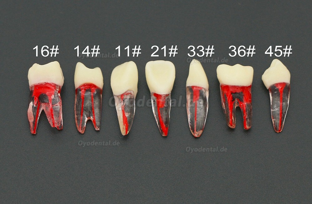 10 Stücke Dental Endodontie Wurzelkanal Praxis Endo Zähne Modell