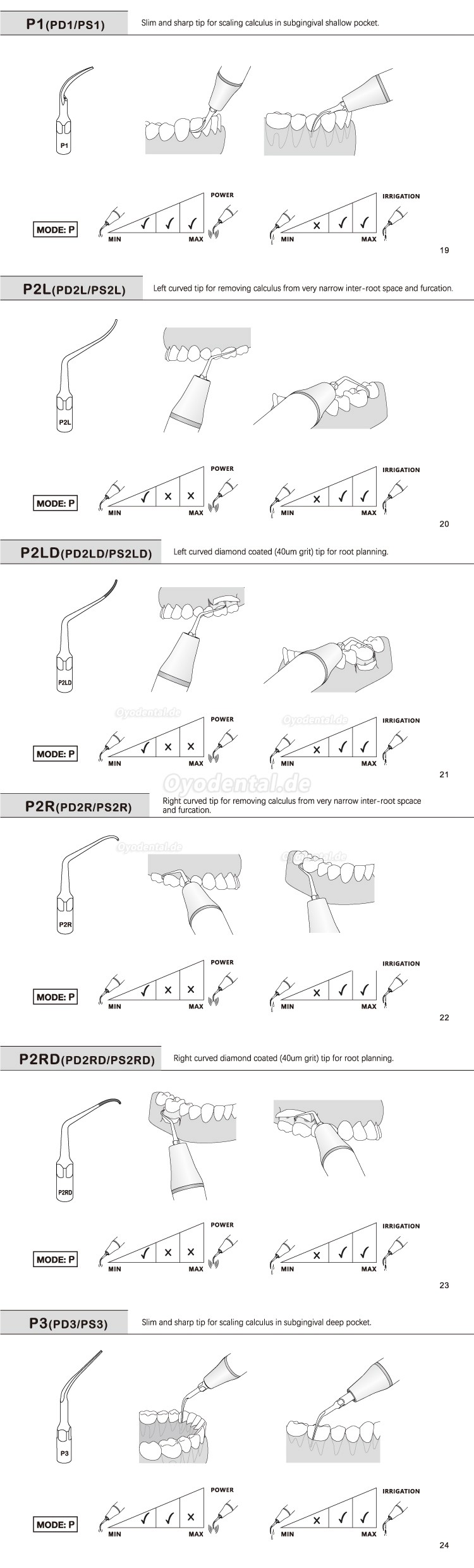 5 Stück Ultraschallspitzen Aufbereitung P2L P2R P2LD P2RD P5 P6 P7 P8 P10 P11 P12 P14L Kompatibel mit Refine EMS Woodpec