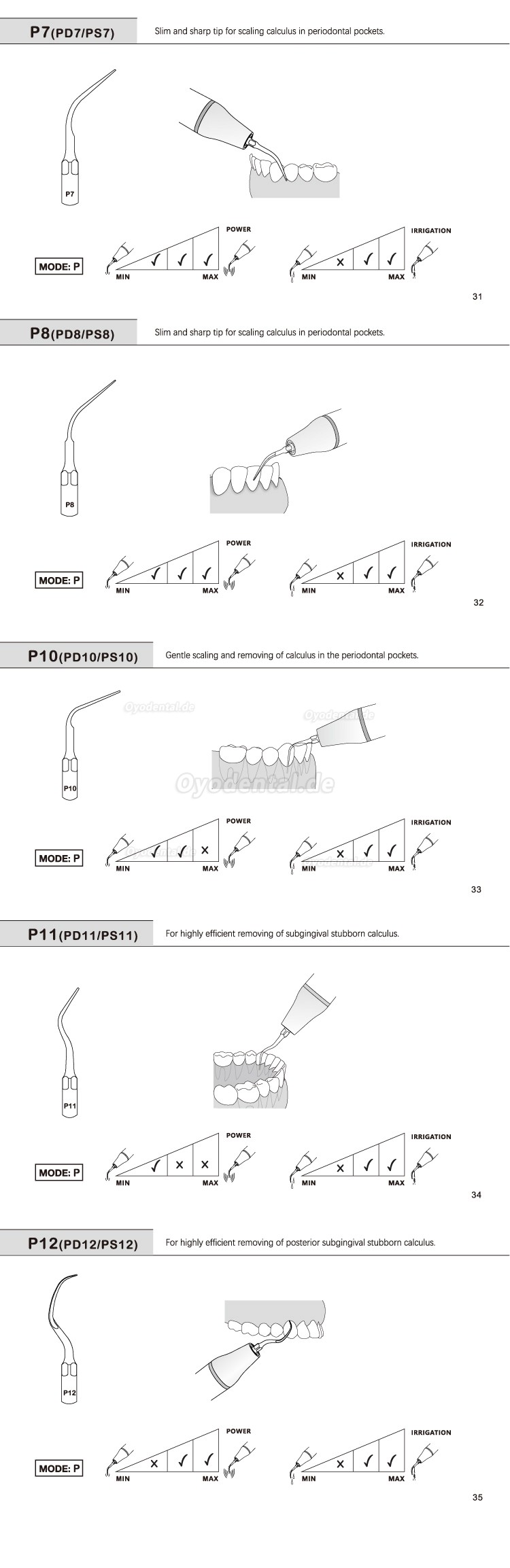 5 Stück Ultraschallspitzen Aufbereitung P2L P2R P2LD P2RD P5 P6 P7 P8 P10 P11 P12 P14L Kompatibel mit Refine EMS Woodpec