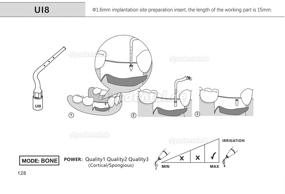 1 Stück Piezochirurgische Ansätze Spitzen Ul1 UI2 UI3 UI4 UI5 für Knochenschneiden Sinus lift Implantate Kompatibel mit