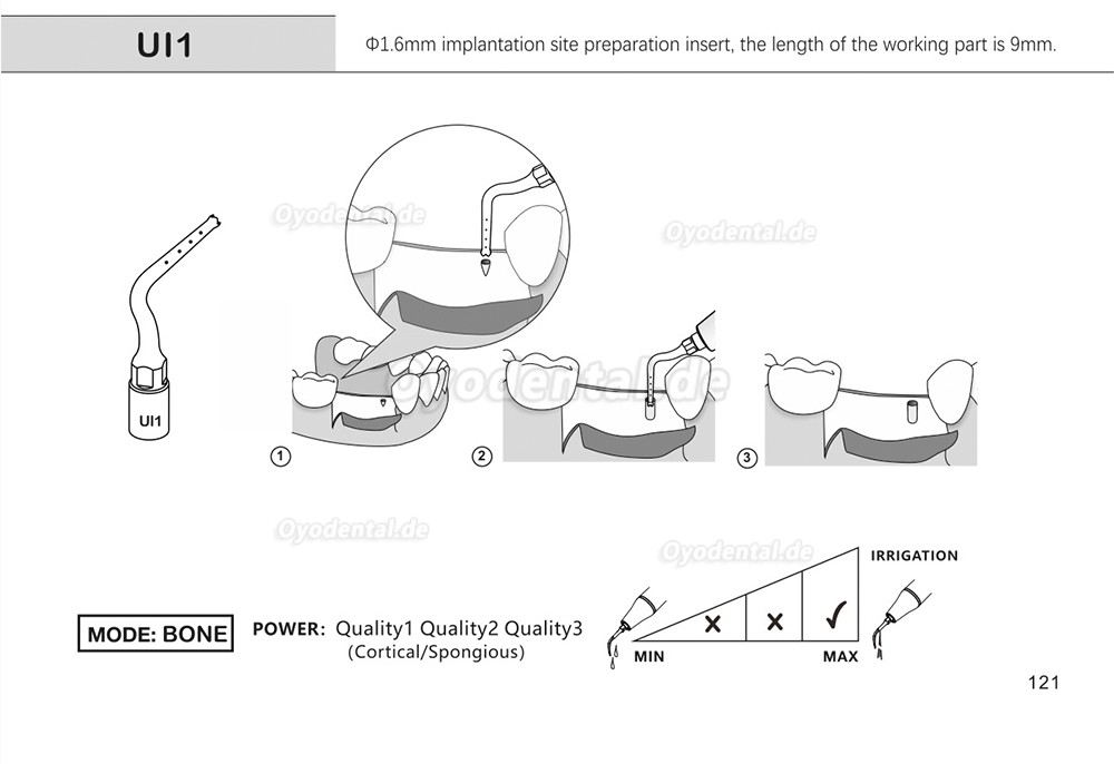 1 Stück Piezochirurgische Ansätze Spitzen Ul1 UI2 UI3 UI4 UI5 für Knochenschneiden Sinus lift Implantate Kompatibel mit