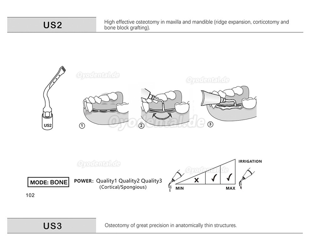 1 Stück Piezochirurgische Ansätze Spitzen US1 US1L US1R US2 US3 US4 US5 US6 US7 US11 US12 für Knochenschneiden Sinus lif