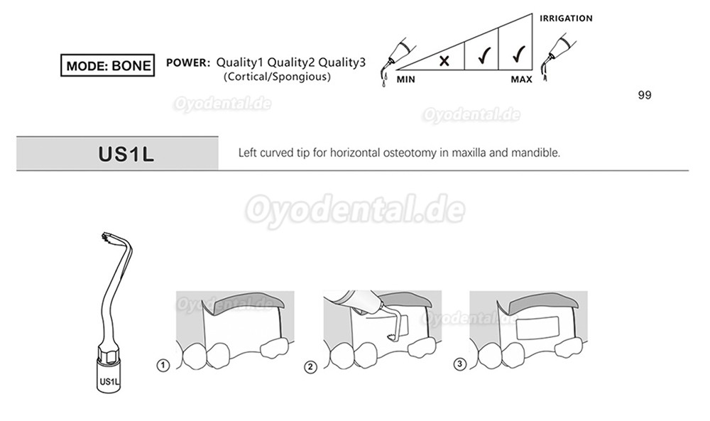 1 Stück Piezochirurgische Ansätze Spitzen US1 US1L US1R US2 US3 US4 US5 US6 US7 US11 US12 für Knochenschneiden Sinus lif