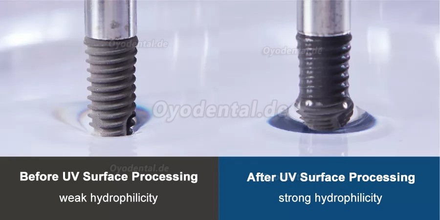 WJ-422 Dental Digital Implant UV Activator Implantate Oberflächenbearbeitungssystem