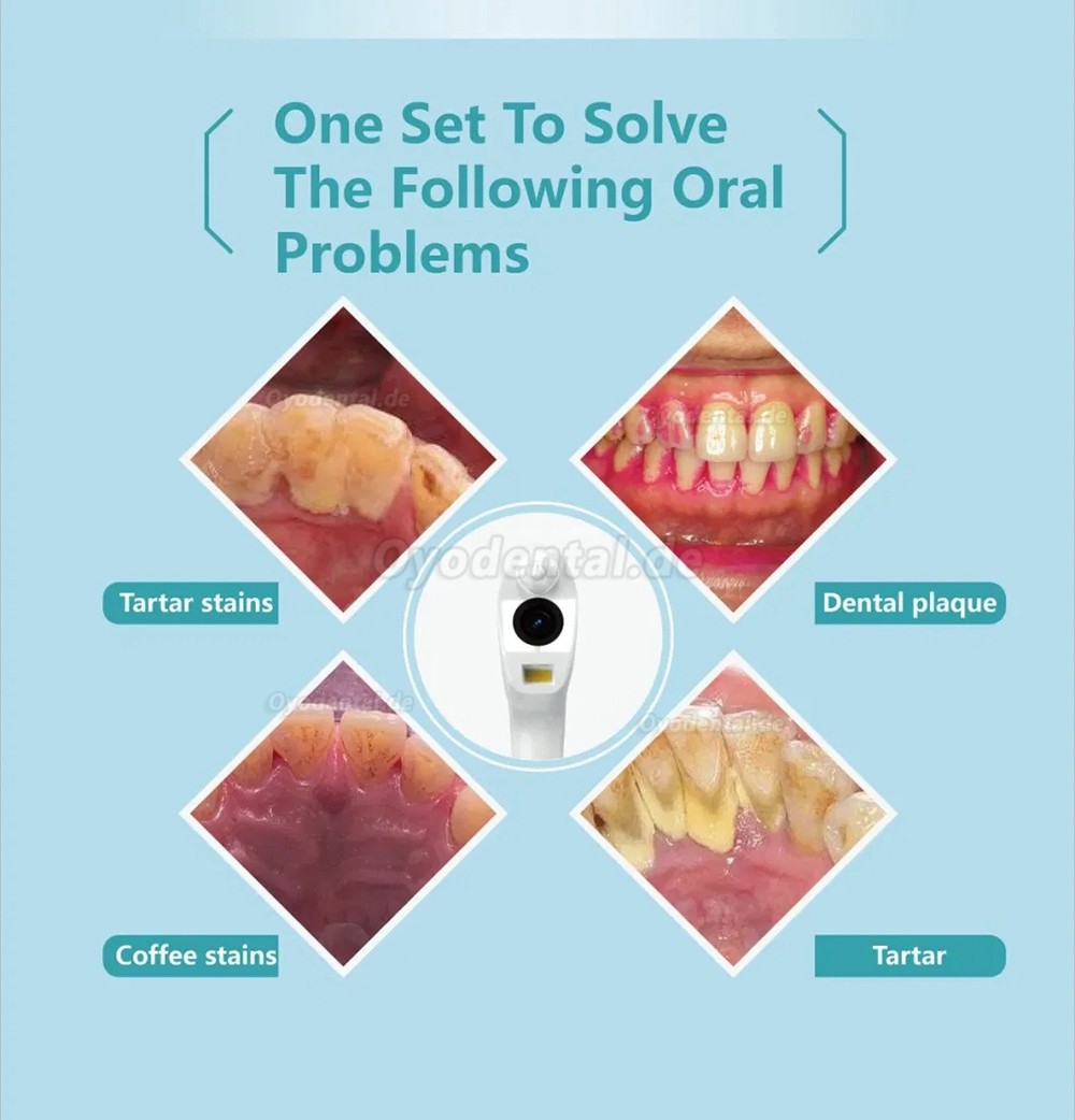 Wasserdichte Dental Wireless WiFi Intraoralkamera für den Heimgebrauch mit Mobiltelefonen