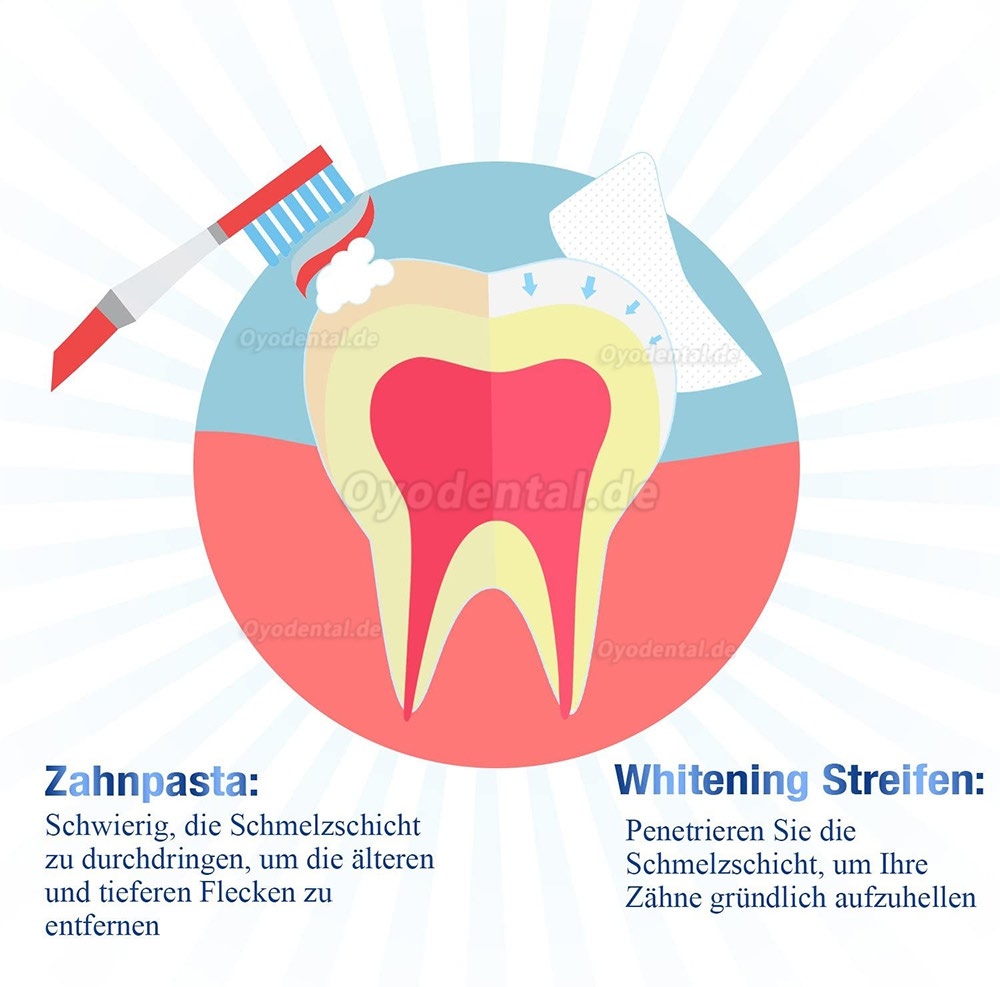 White Stripes 3D Zahnaufhellung mit 56 Streifen gegen Gelbe Zähne Rauchflecken Schwarze Zähne mit Advanced no-slip Techn