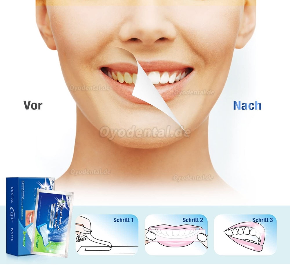 White Stripes 3D Zahnaufhellung mit 56 Streifen gegen Gelbe Zähne Rauchflecken Schwarze Zähne mit Advanced no-slip Techn