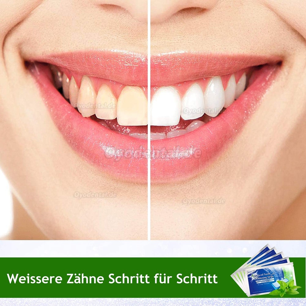 White Stripes 3D Zahnaufhellung mit 56 Streifen gegen Gelbe Zähne Rauchflecken Schwarze Zähne mit Advanced no-slip Techn