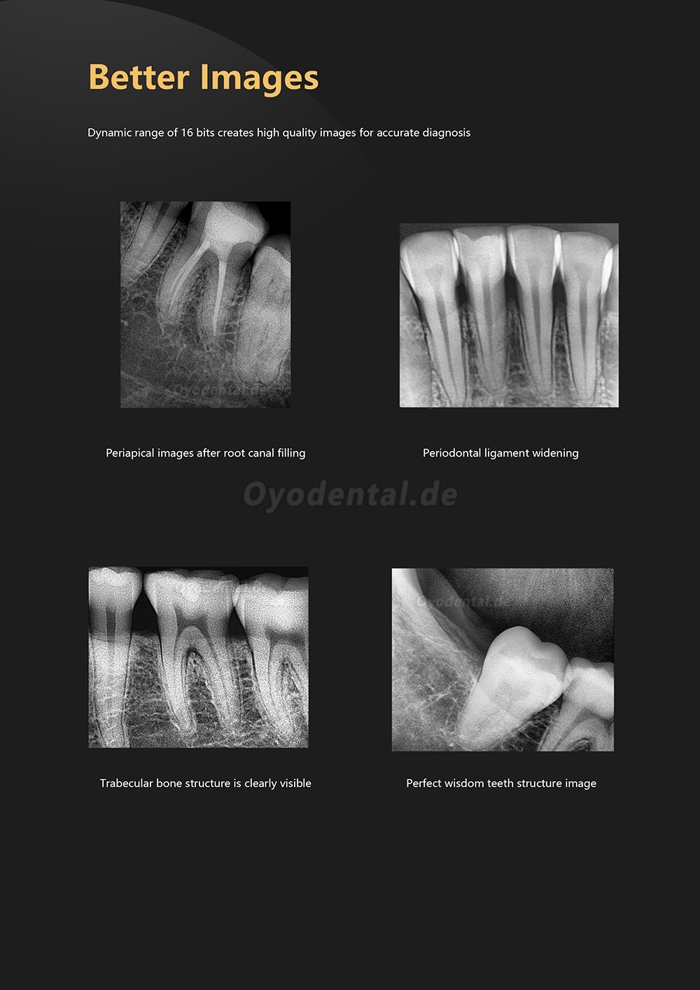 Dental RVG Digitaler Röntgensensor Intraoraler Röntgensensor Intraoralsensoren