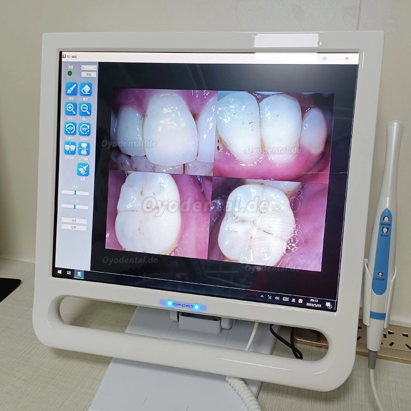 YF-1700P+ 17-Zoll Dental-Intraoralkamera Touch LCD-Bildschirm für Dentaleinheit mit Halterung