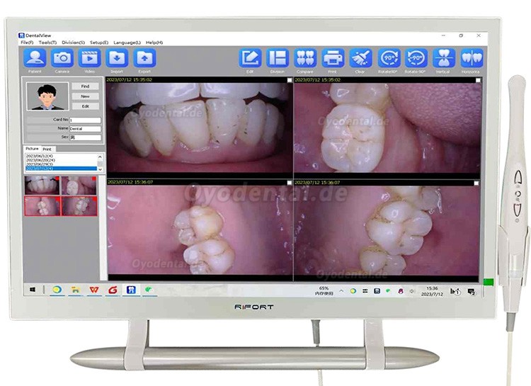 Magenta YF-2200P+21,5-Zoll-LCD-Monitor Touchscreen Intraoralkamera VGA + HDMI