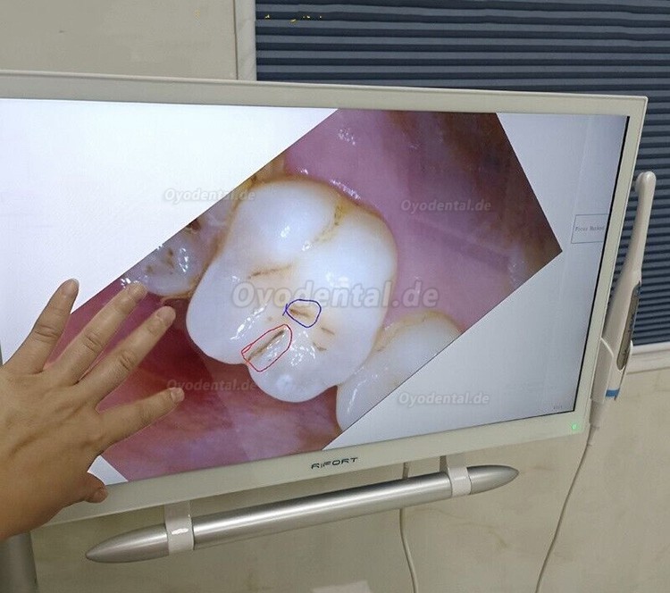 Magenta YF-2200P+21,5-Zoll-LCD-Monitor Touchscreen Intraoralkamera VGA + HDMI
