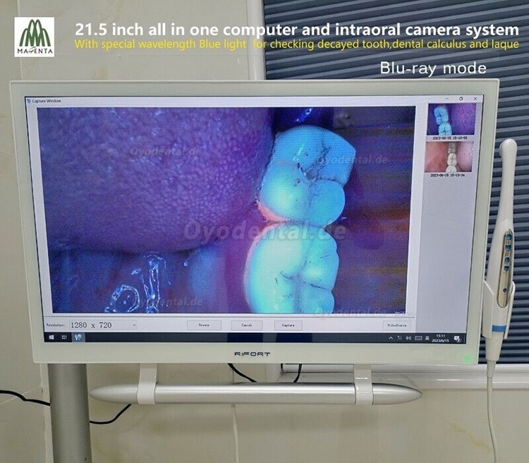 Magenta YF-2200P+21,5-Zoll-LCD-Monitor Touchscreen Intraoralkamera VGA + HDMI