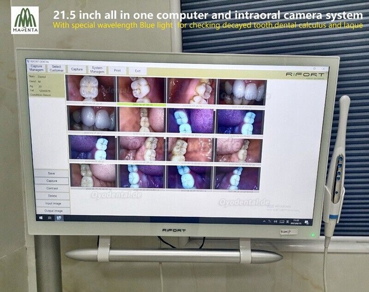 Magenta YF-2200P+21,5-Zoll-LCD-Monitor Touchscreen Intraoralkamera VGA + HDMI